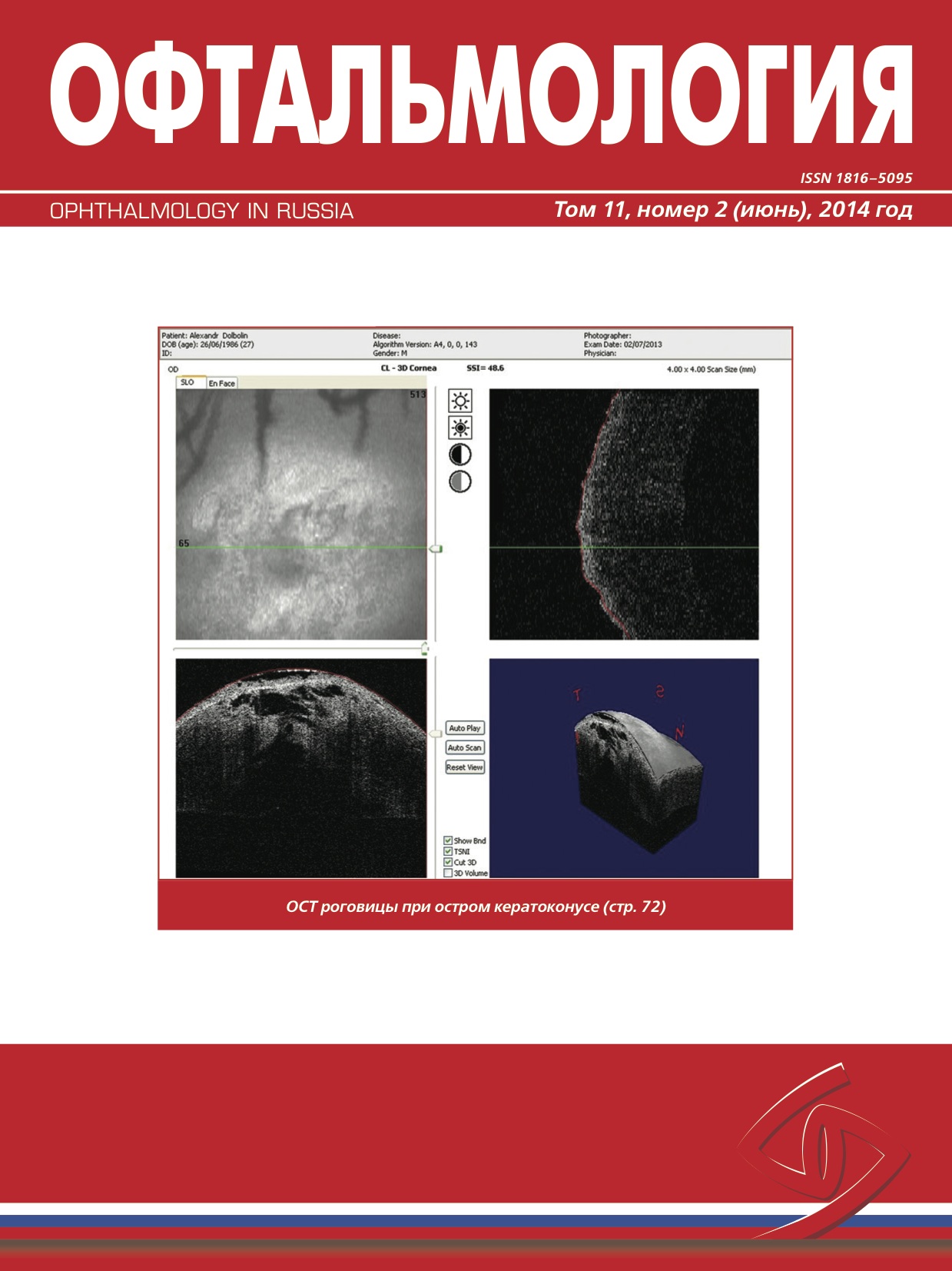 Ophthalmology